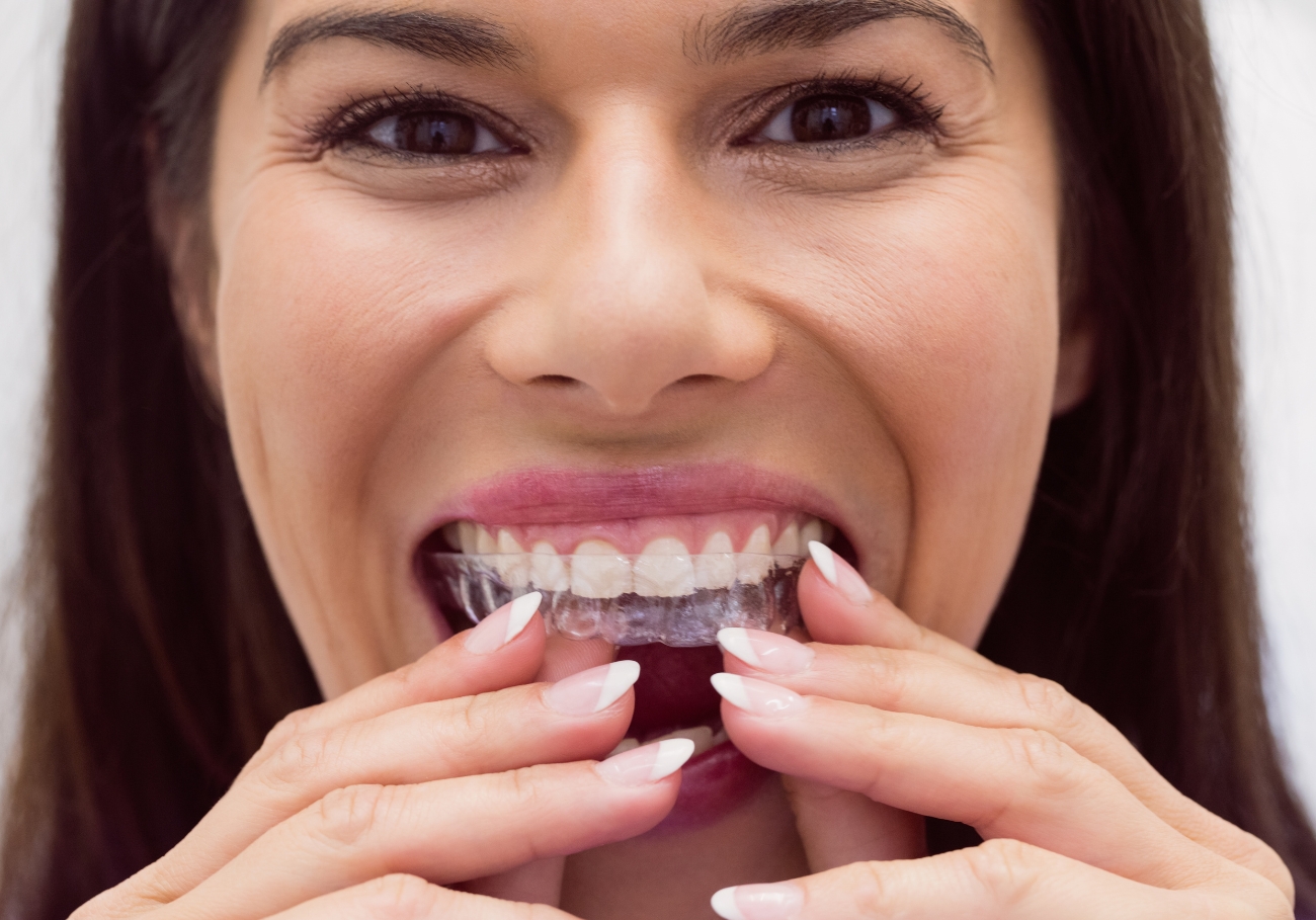 Teeth alignment treatment in Coimbatore using advanced clear aligners