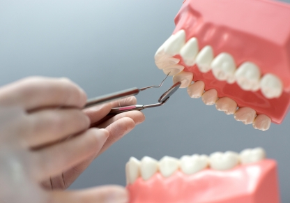 Full teeth replacement in Coimbatore with advanced dental care